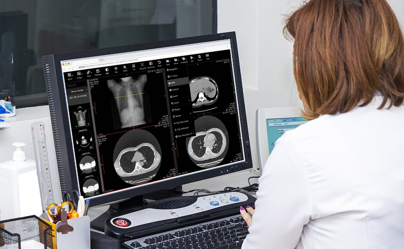 Inteligência artificial na radiologia