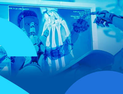 Inteligência Artificial Na Radiologia