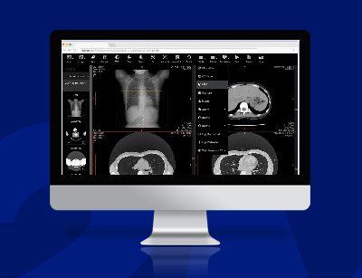 Software Para Radiologia: Como Encontrar A Melhor Solução Para A Gestão Completa Do Seu Centro De Imagem?
